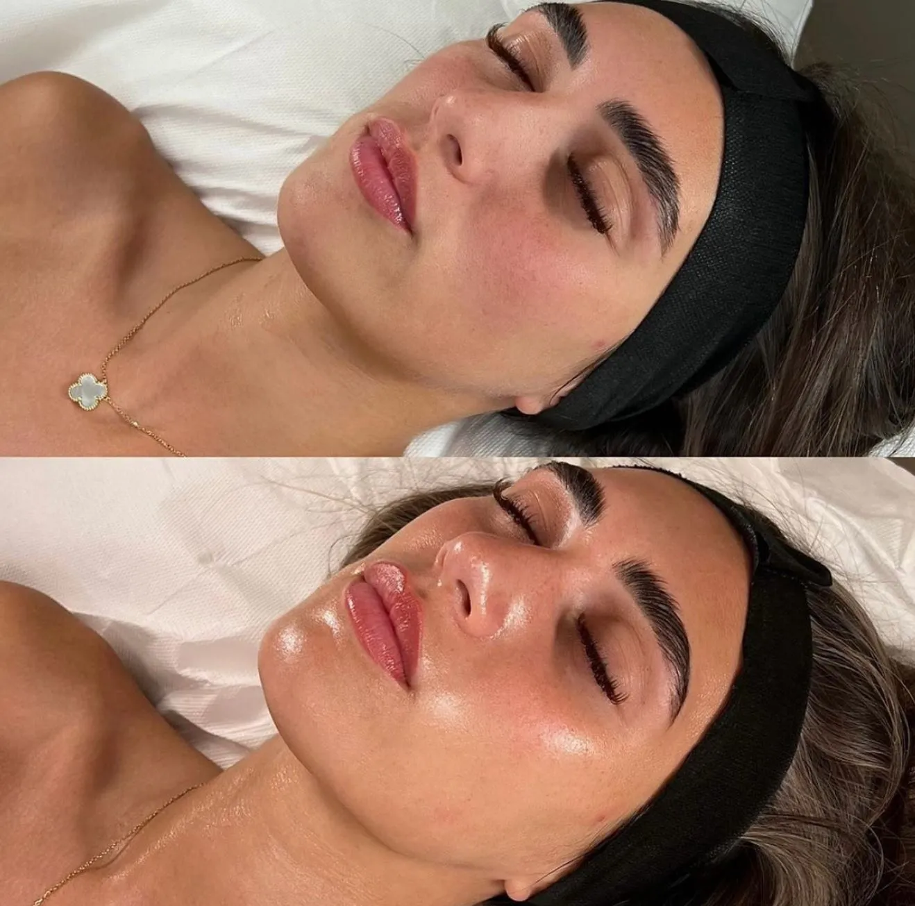 Aftercare, Keeping the Glow Alive