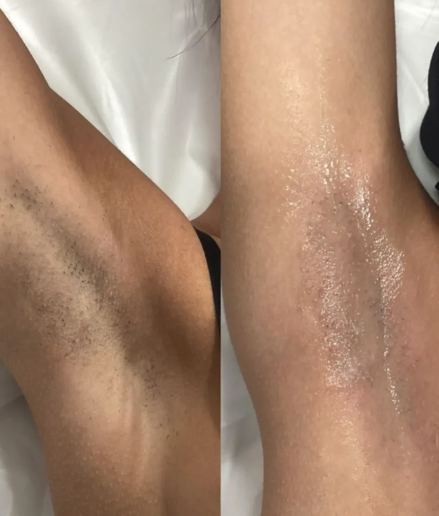 Clinics Downplay Hair & Skin Tone