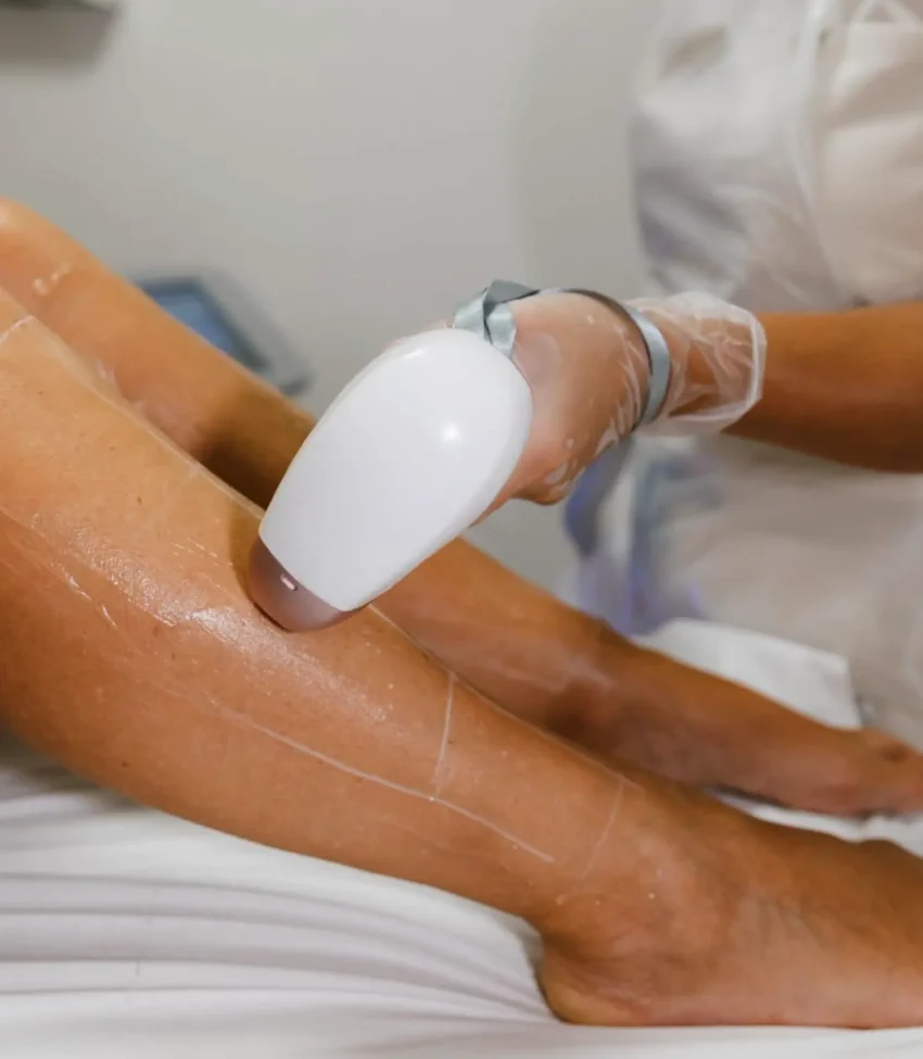 What I Wish I’d Known Before Getting Laser Hair Removal