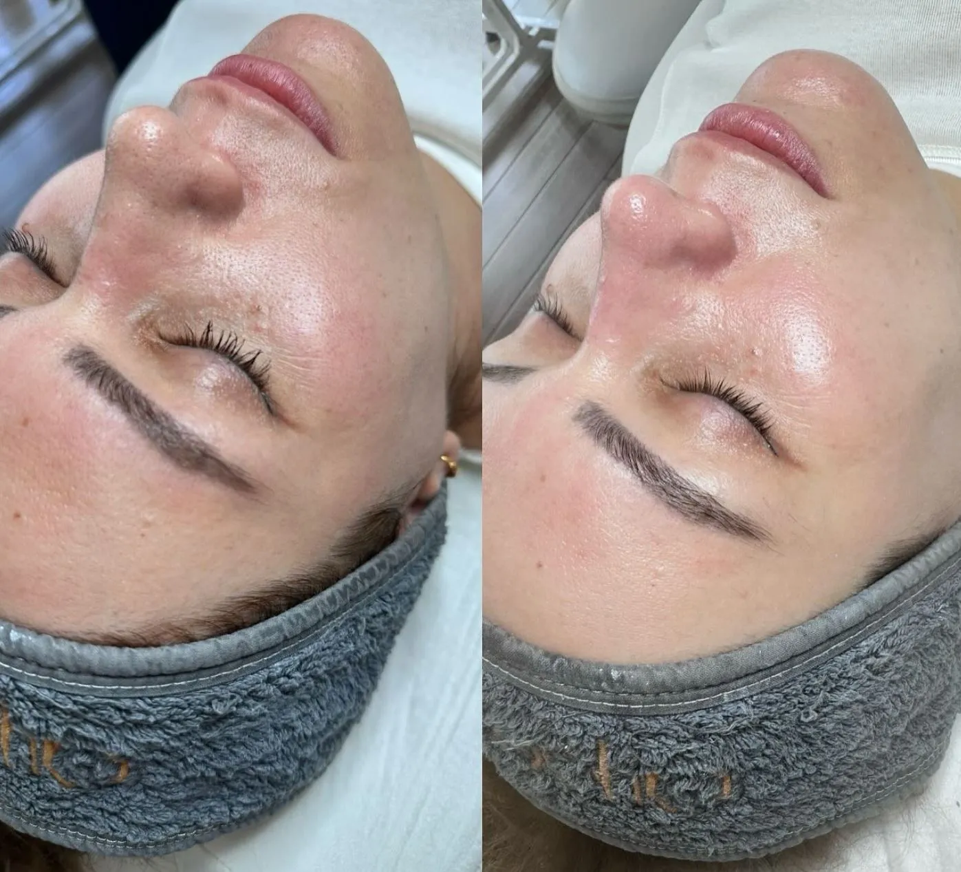 What It Really Does for Your Skin