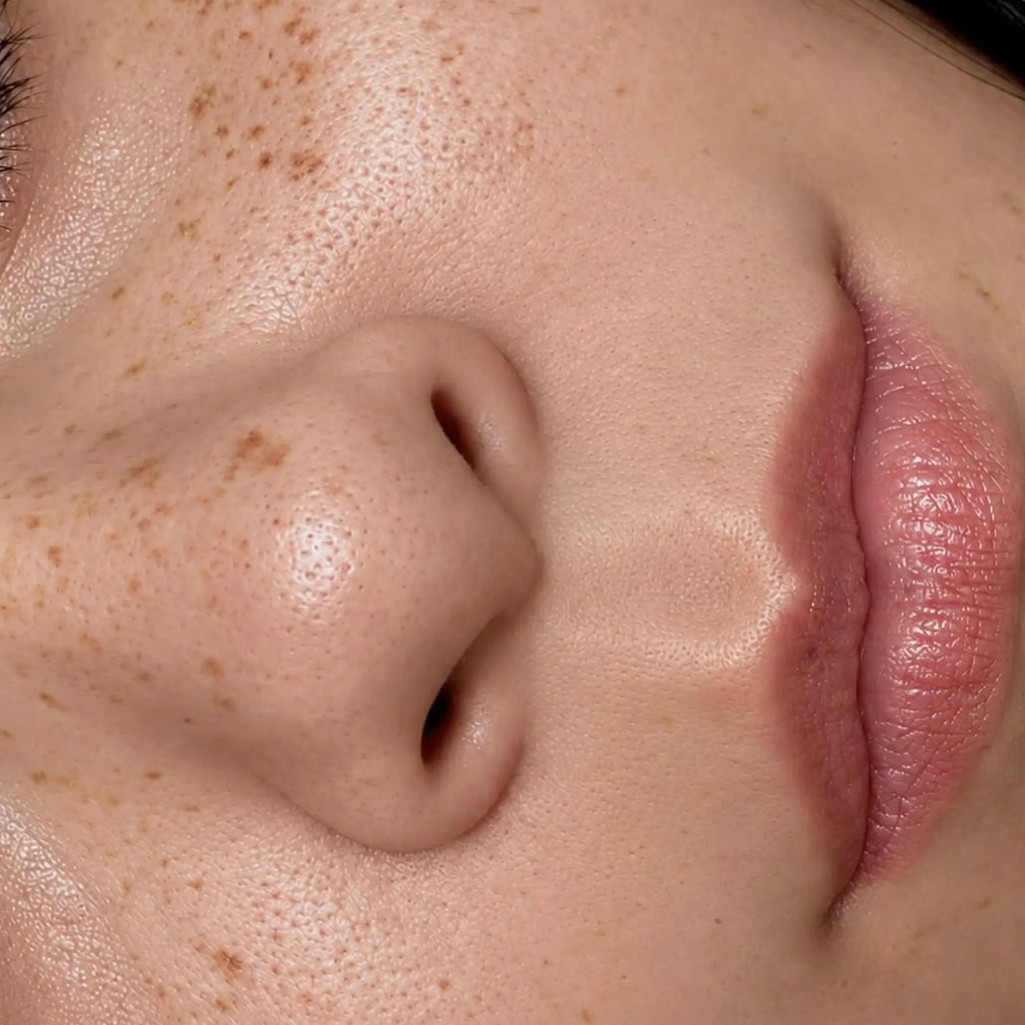 natural freckles on skin