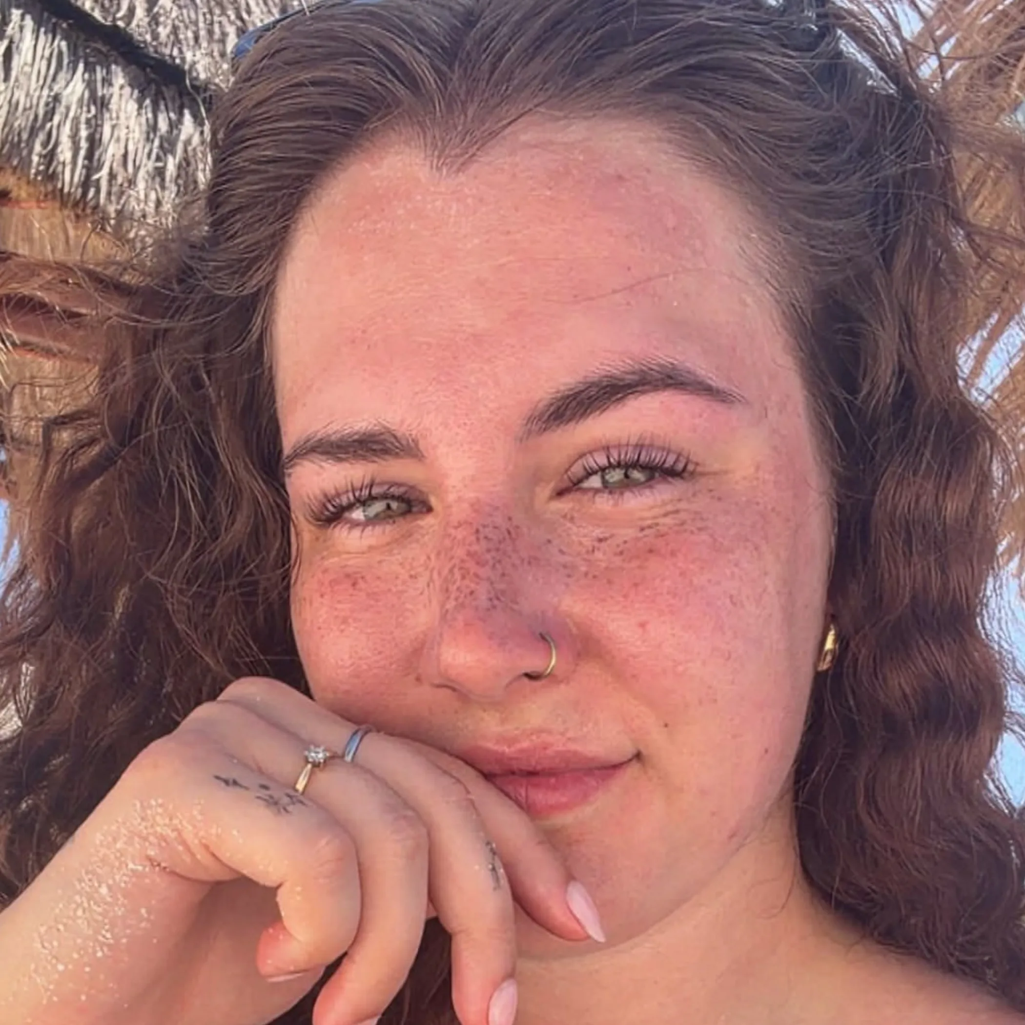 close-up view of facial freckles