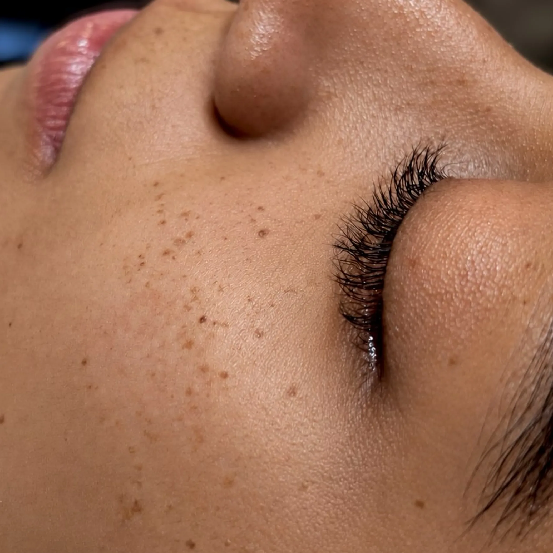 freckles and beauty marks close-up